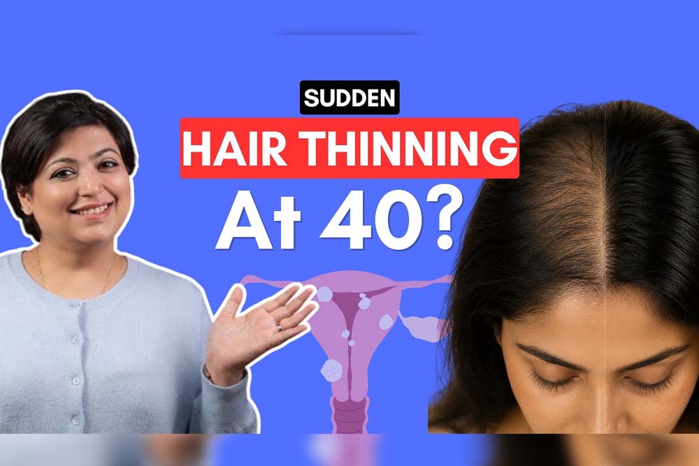 Perimenopausal Hair Thinning