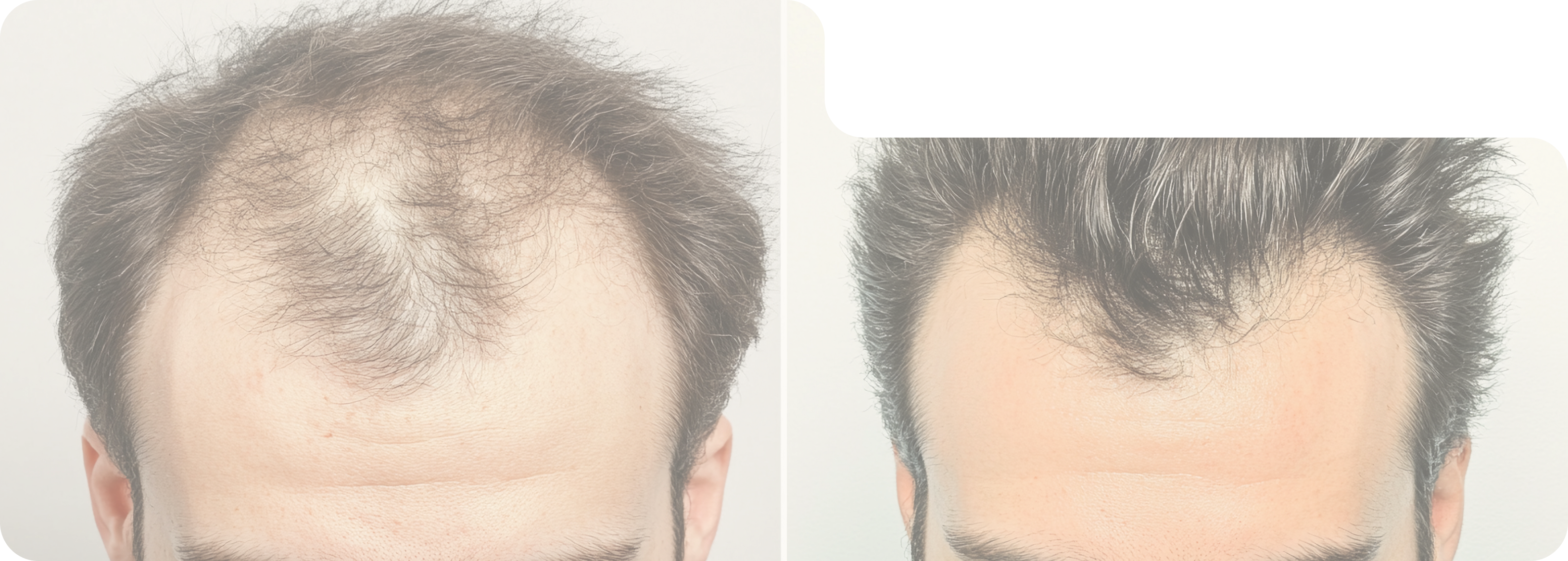 Consultation Result