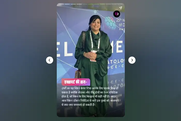 Media coverage